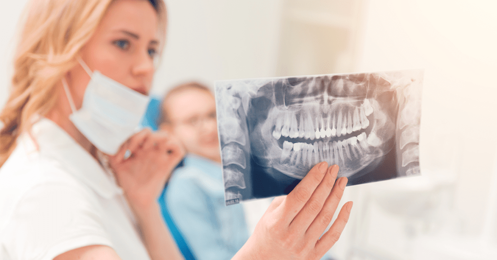 wisdom teeth extraction